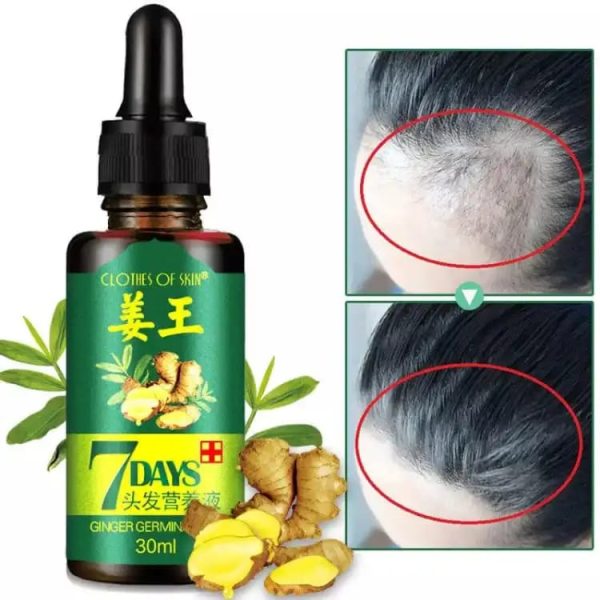 Hair Growth Germinal Serum Oil (30ml)