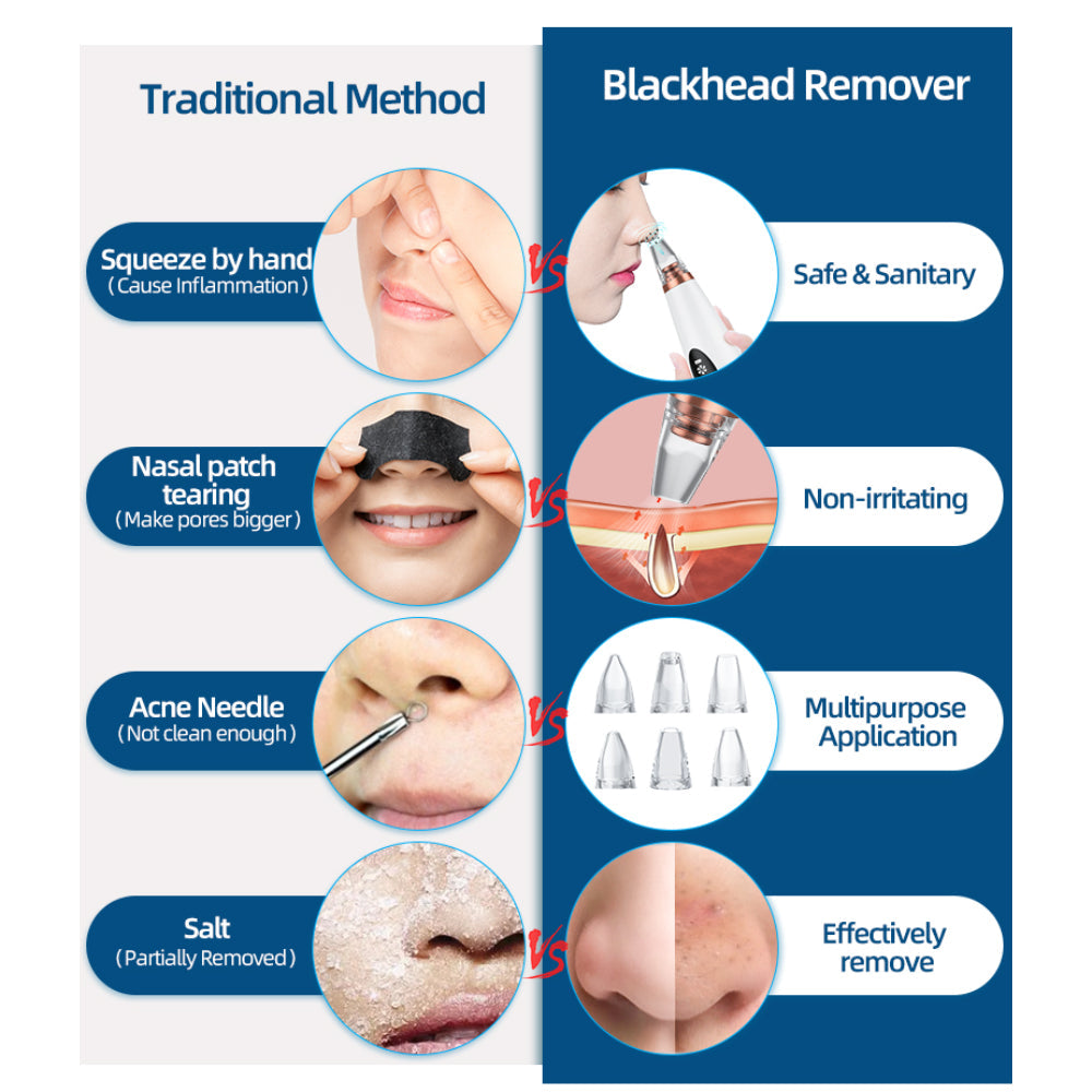 6 Suction Heads Blackhead Whitehead Extractor Remover Device Suction Tool